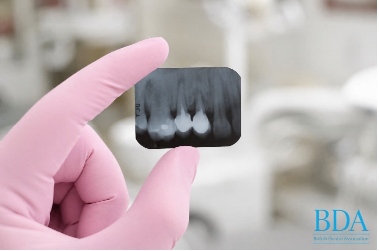 Dental Radiography